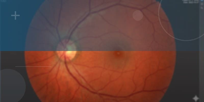 Newmedica eye surgery clinics